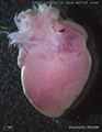 A human fetal heart