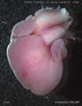 A human fetal heart
