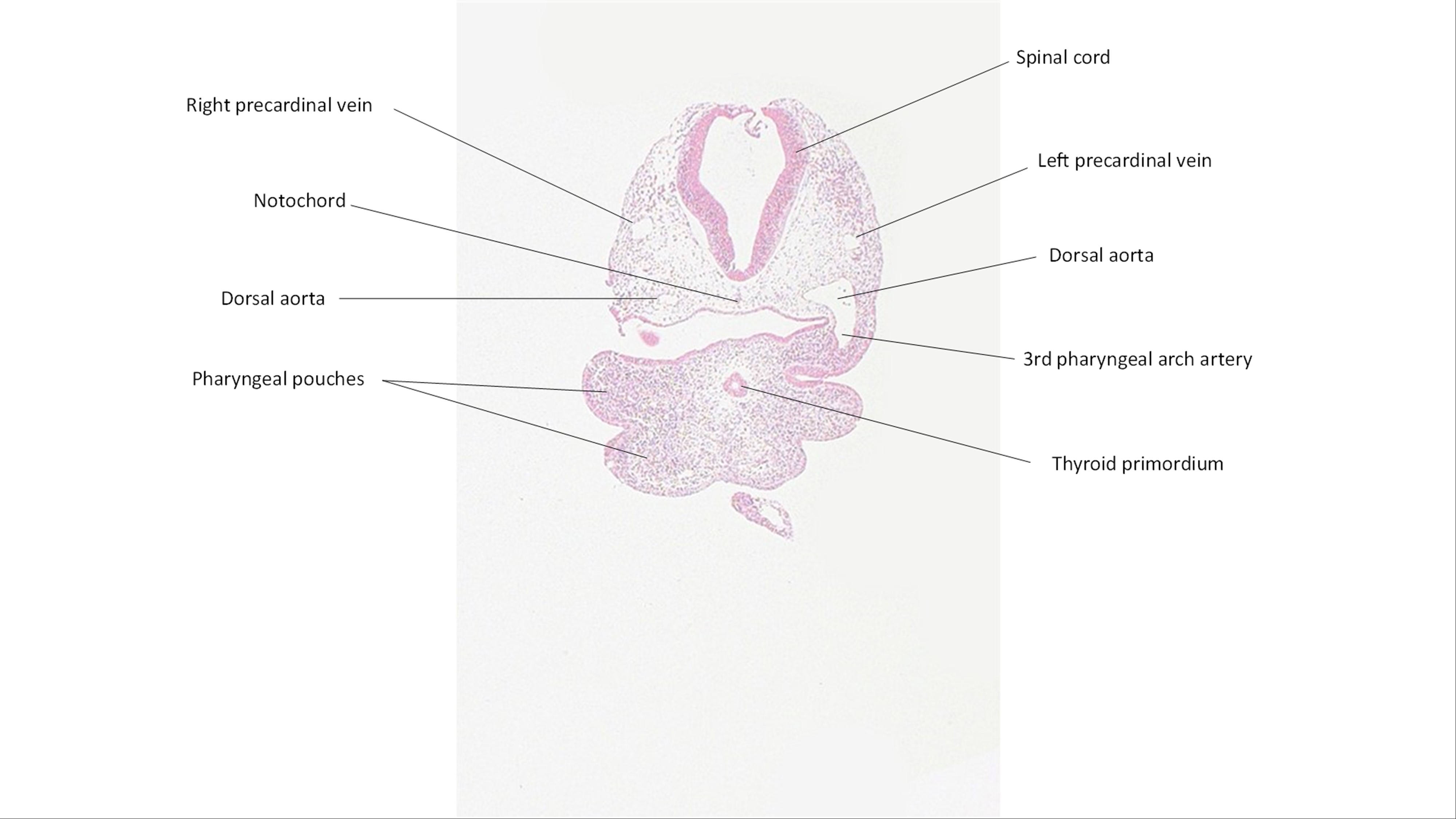 A histology section of a human embryo