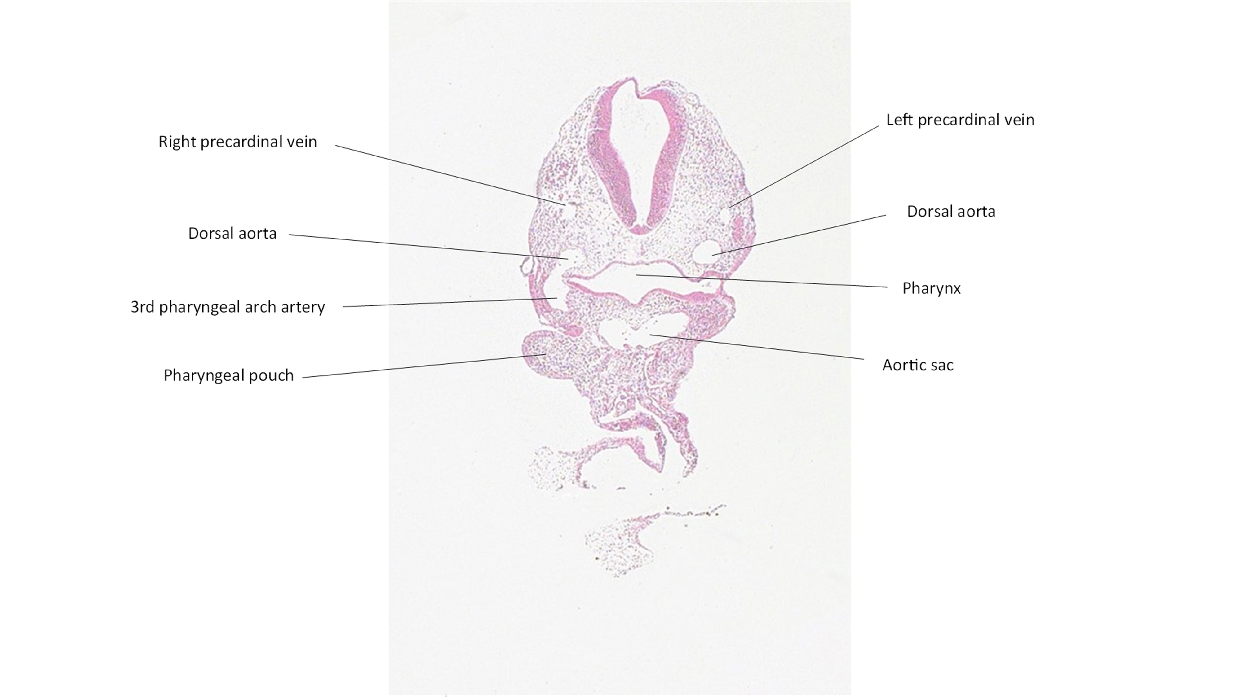 A histology section of a human embryo