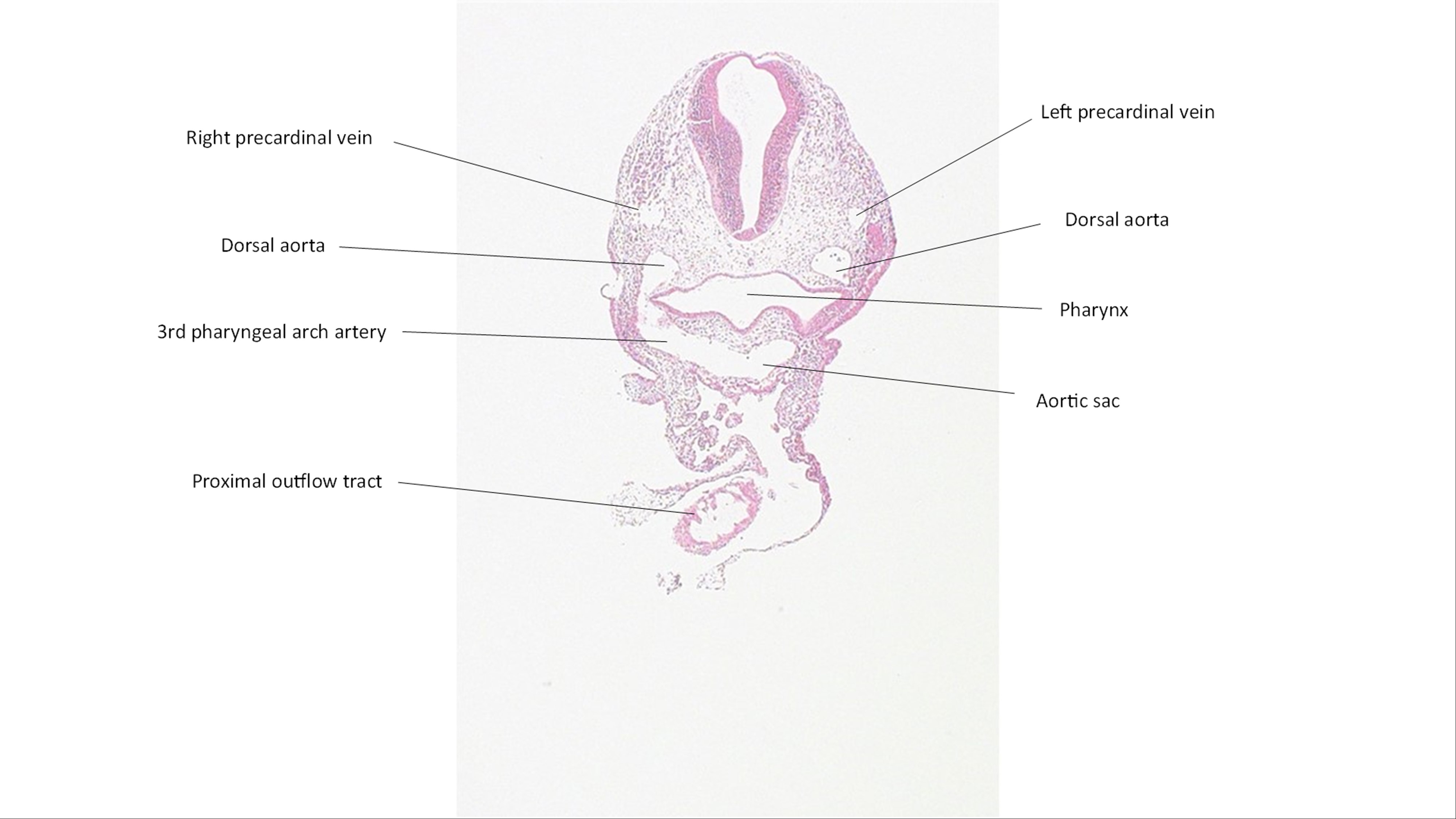 A histology section of a human embryo