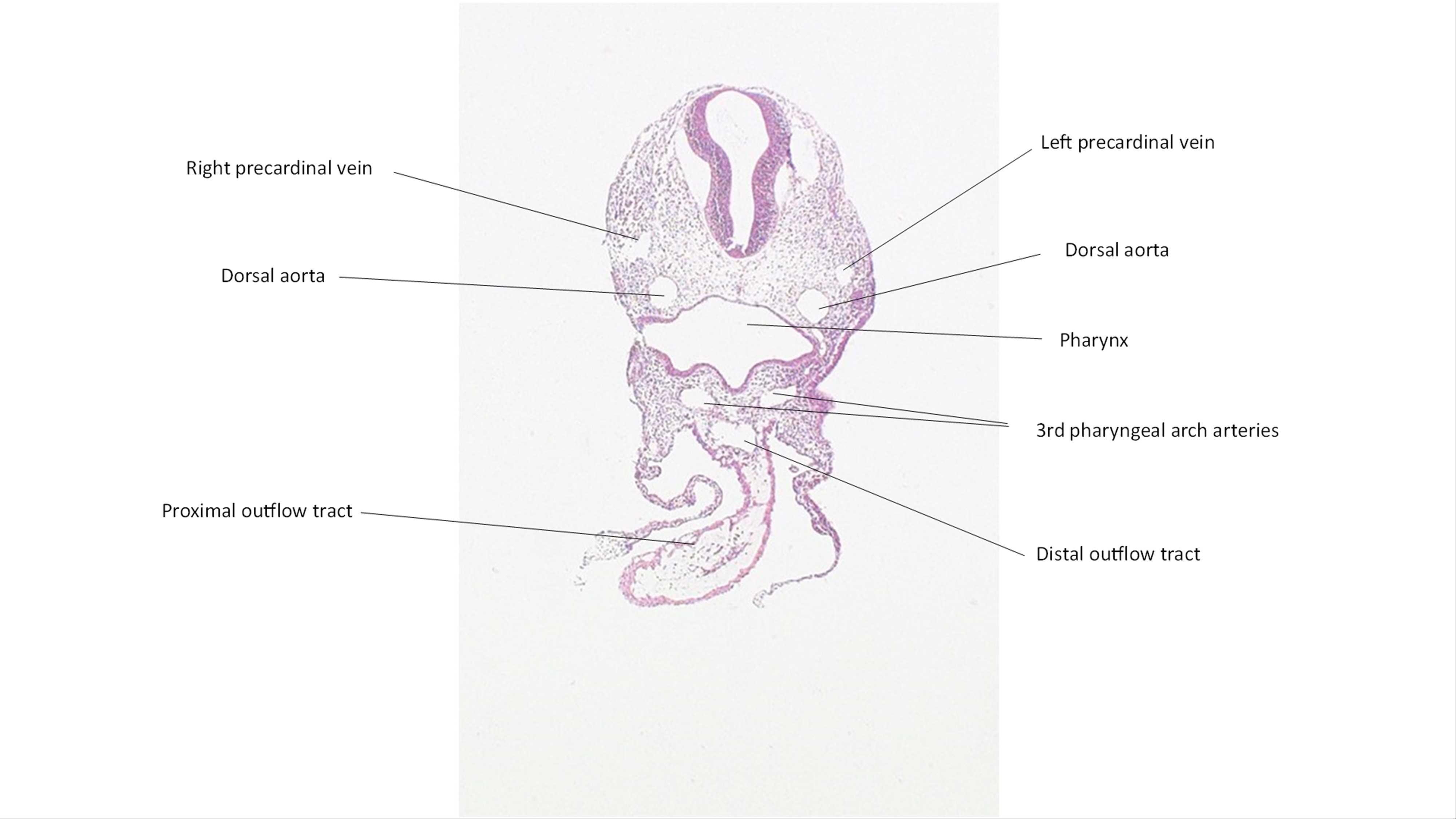 A histology section of a human embryo