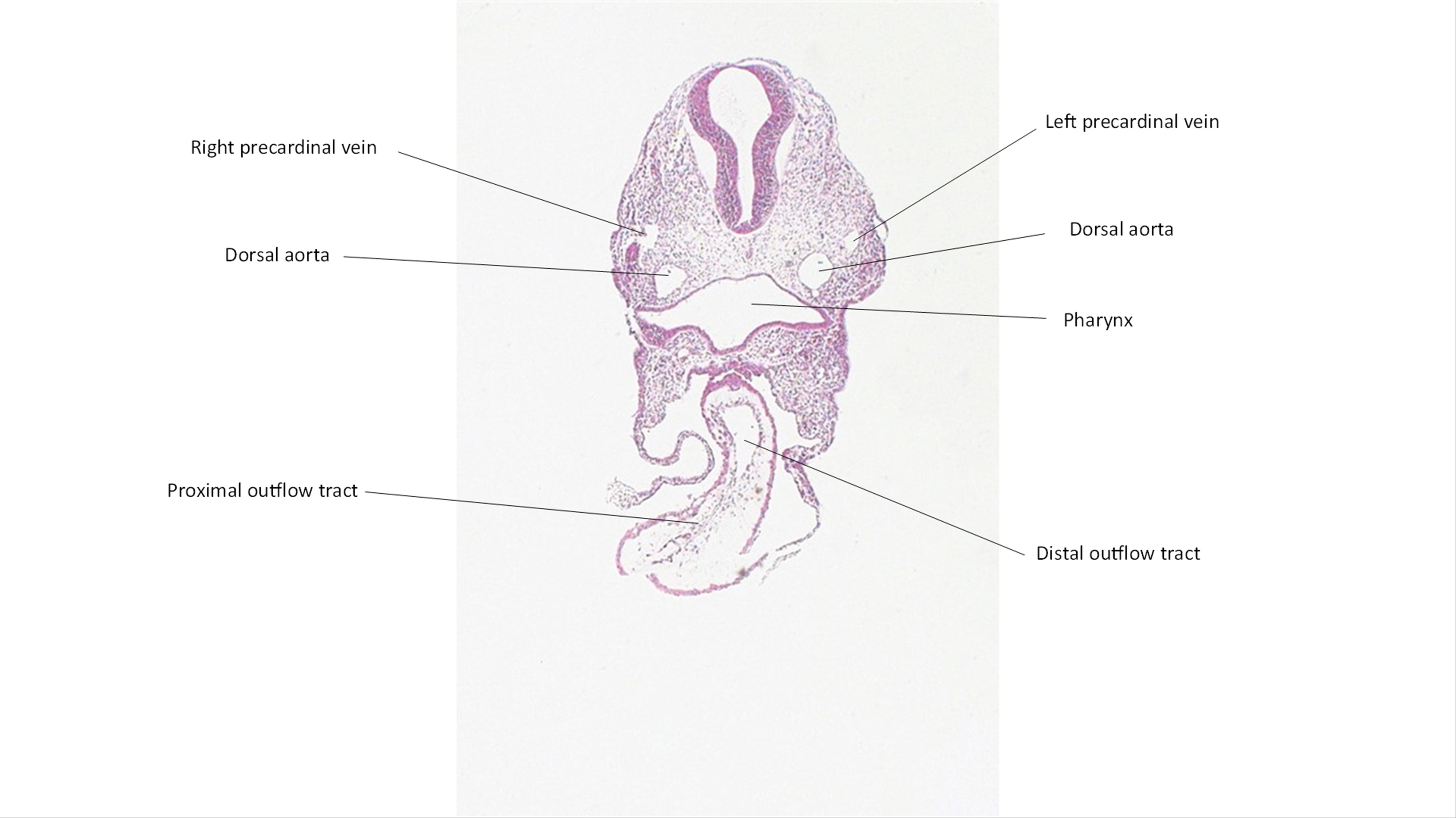 A histology section of a human embryo