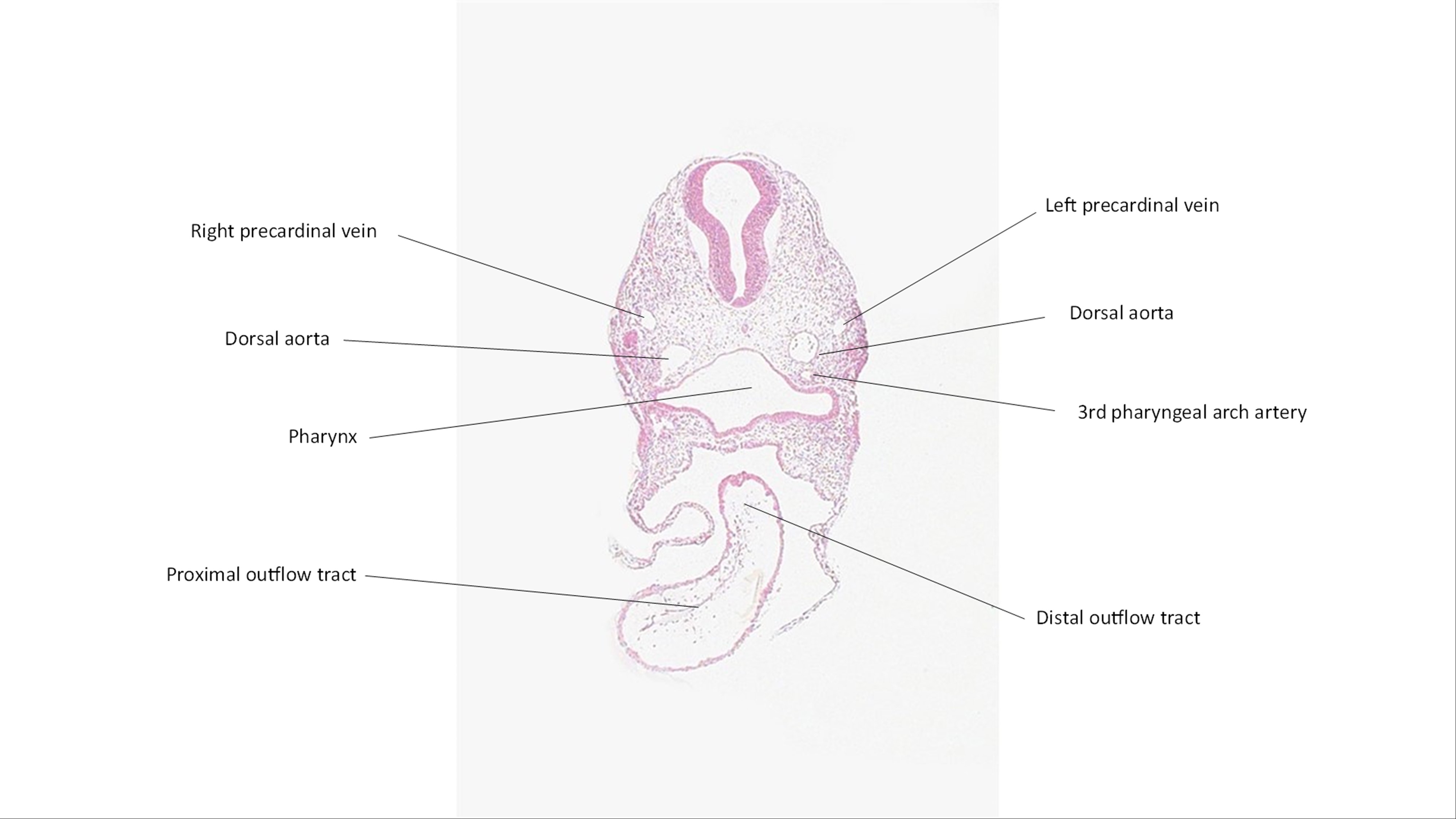 A histology section of a human embryo