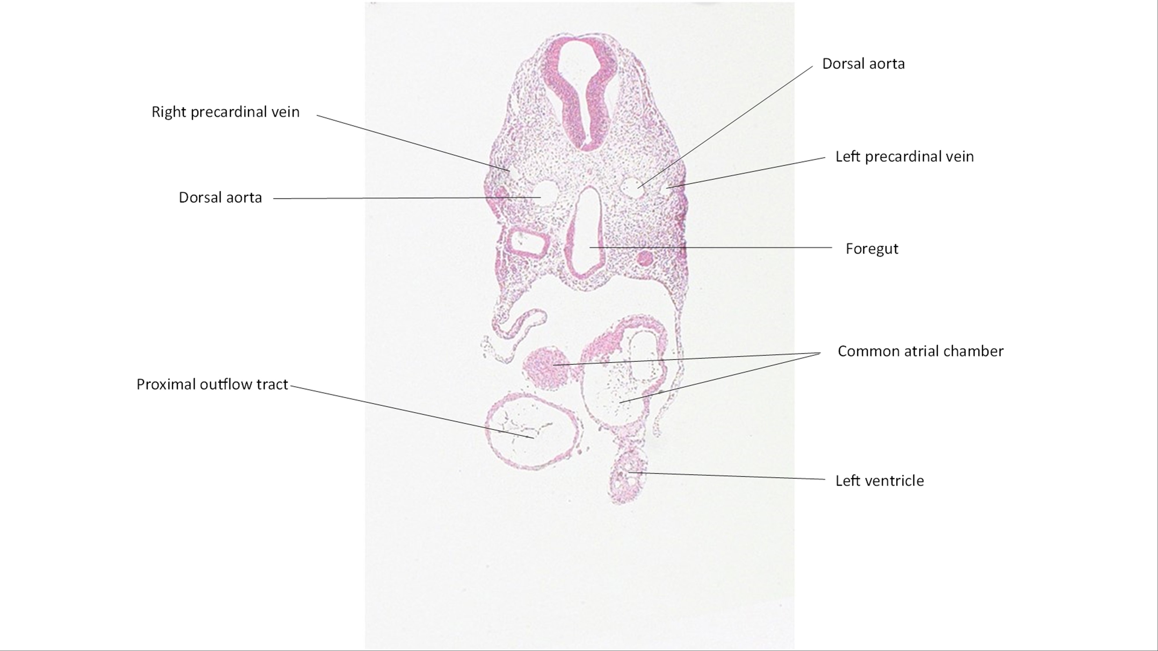 A histology section of a human embryo