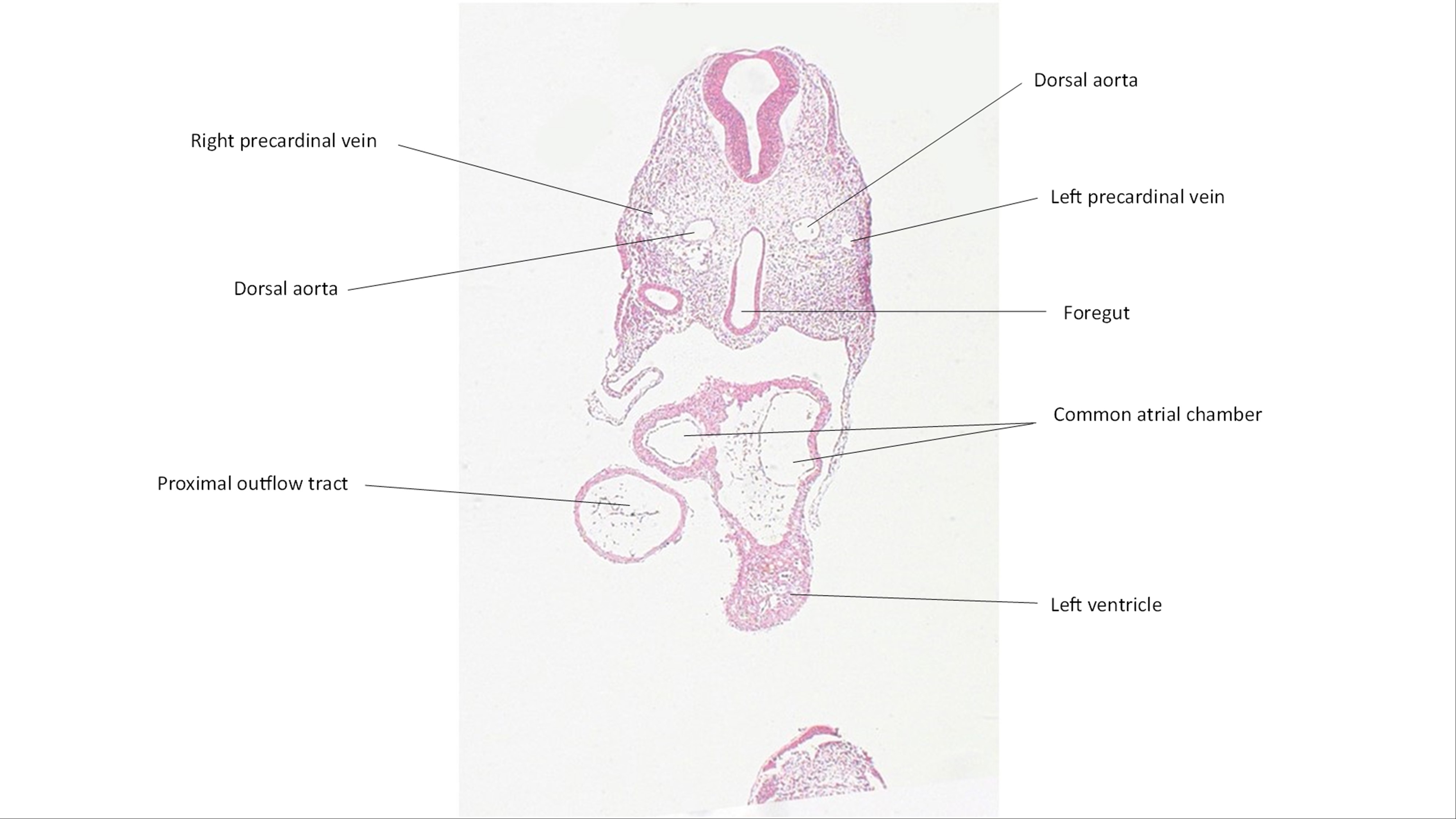 A histology section of a human embryo