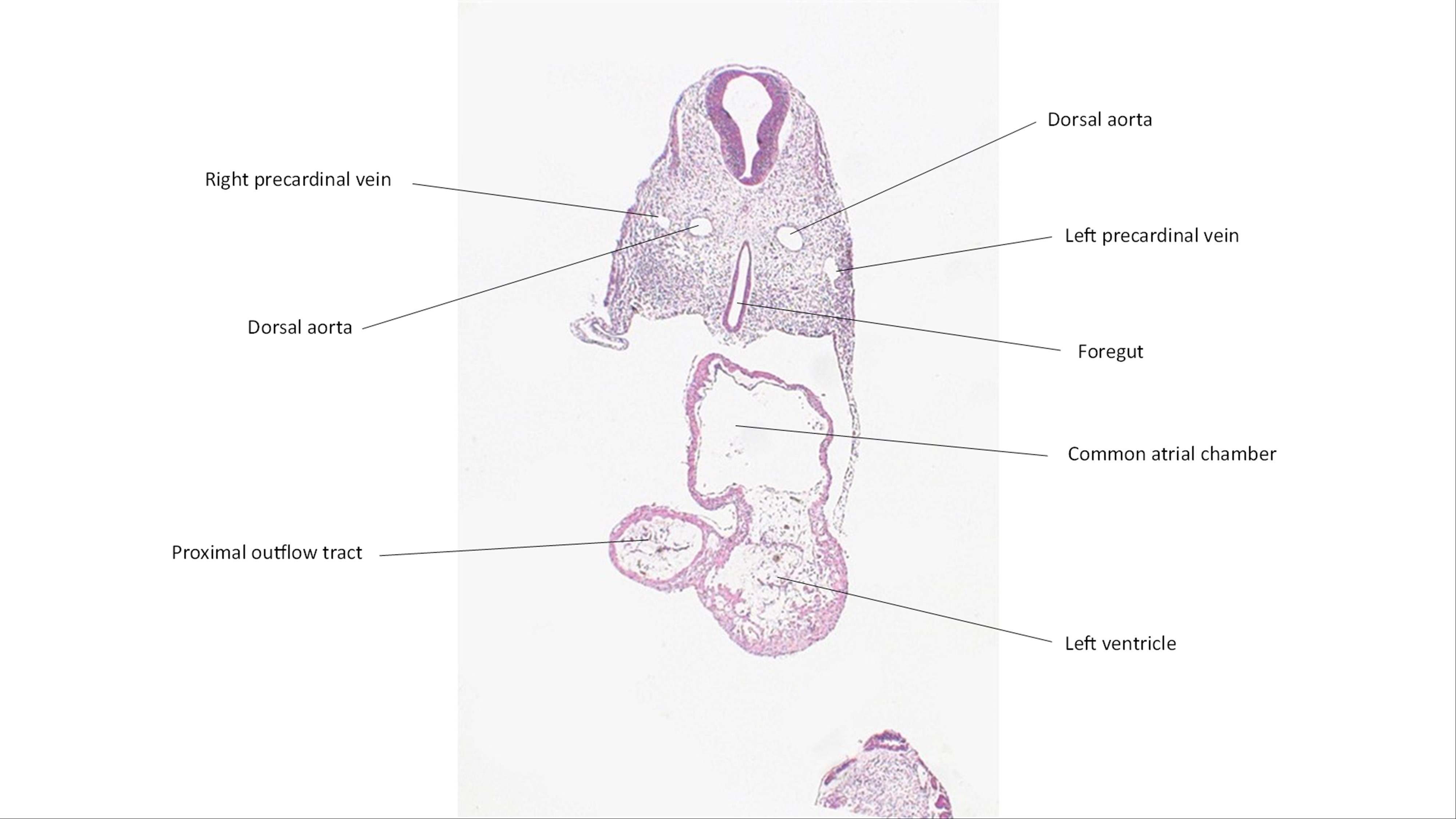 A histology section of a human embryo
