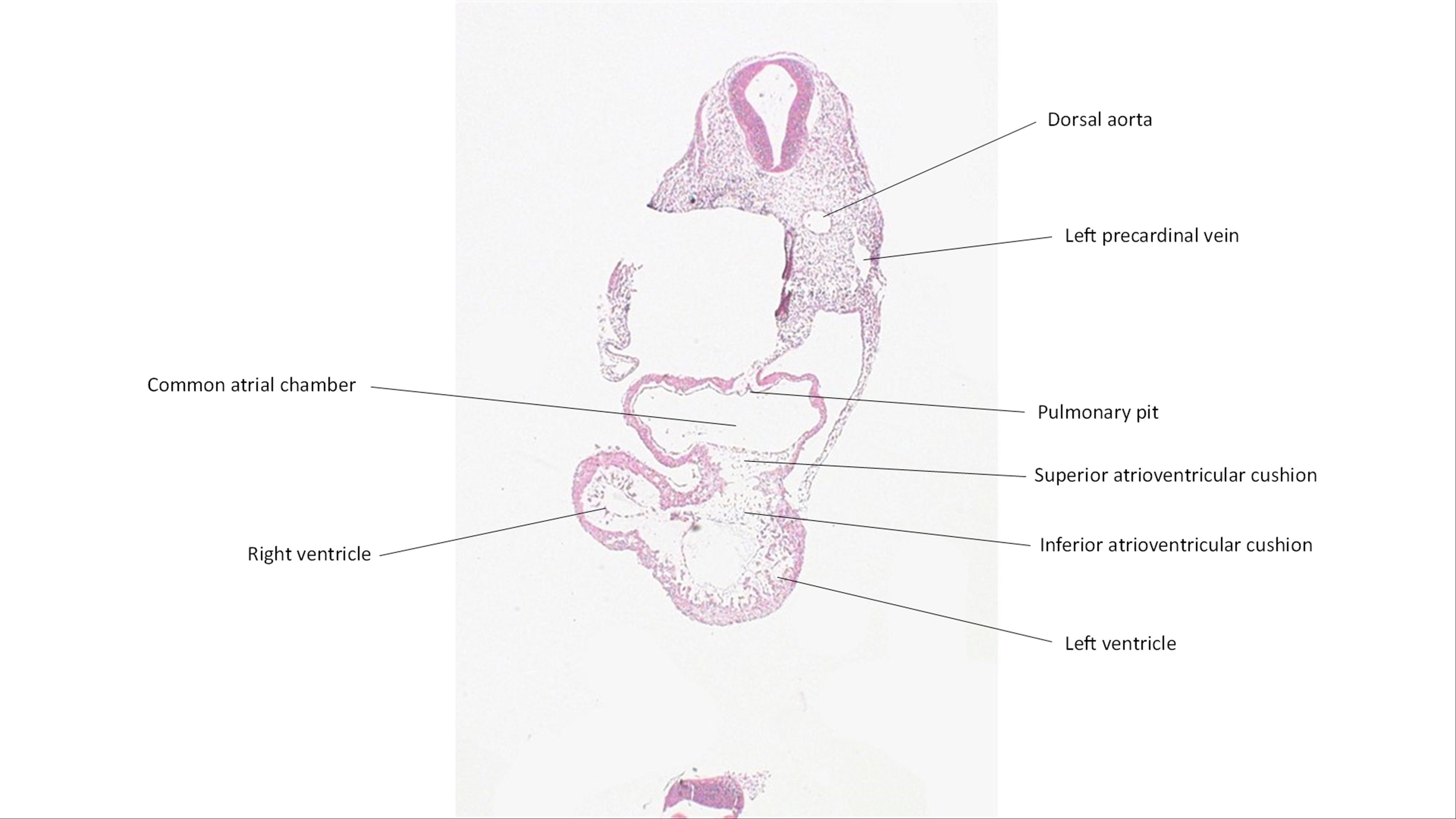 A histology section of a human embryo