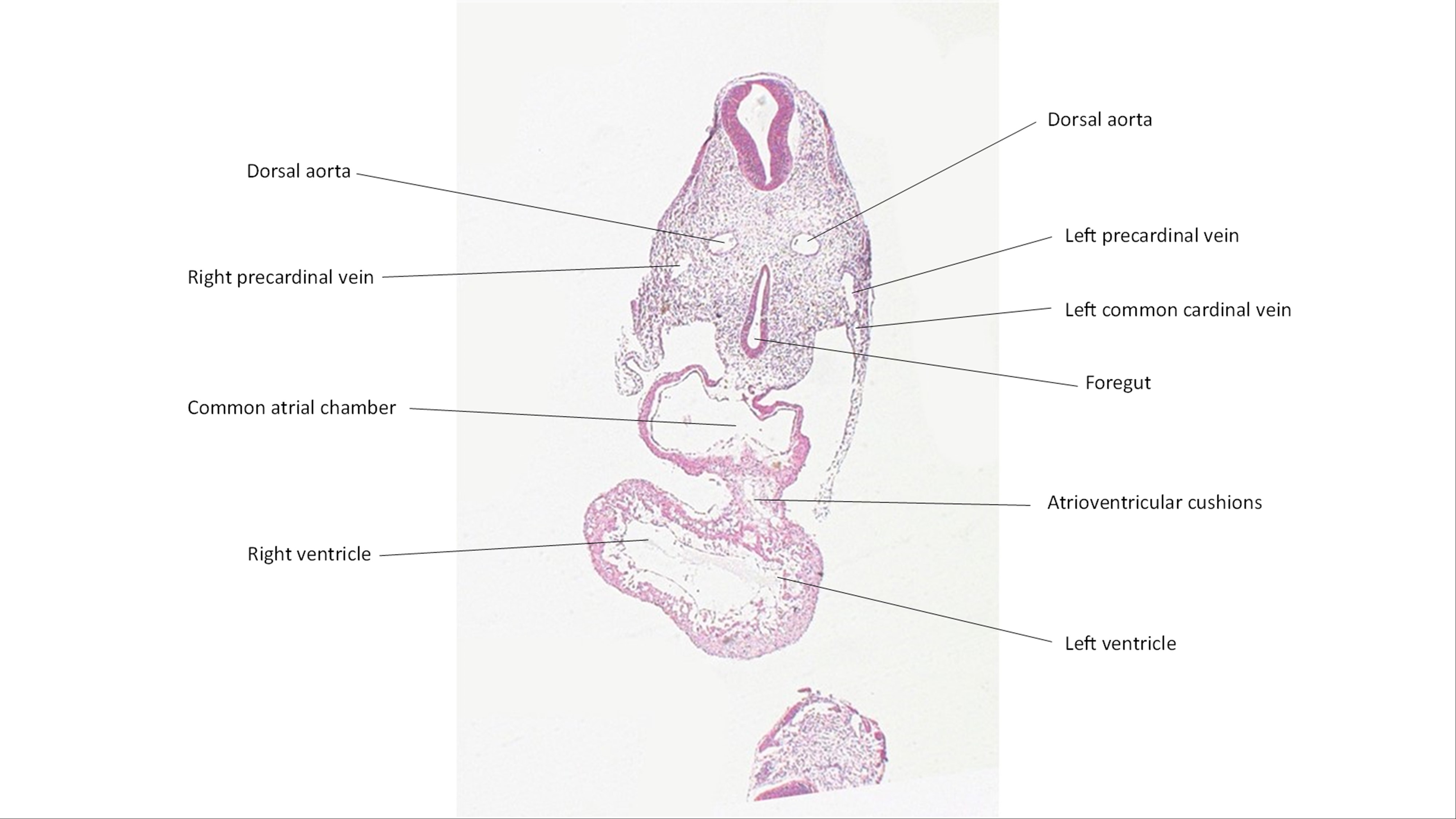 A histology section of a human embryo