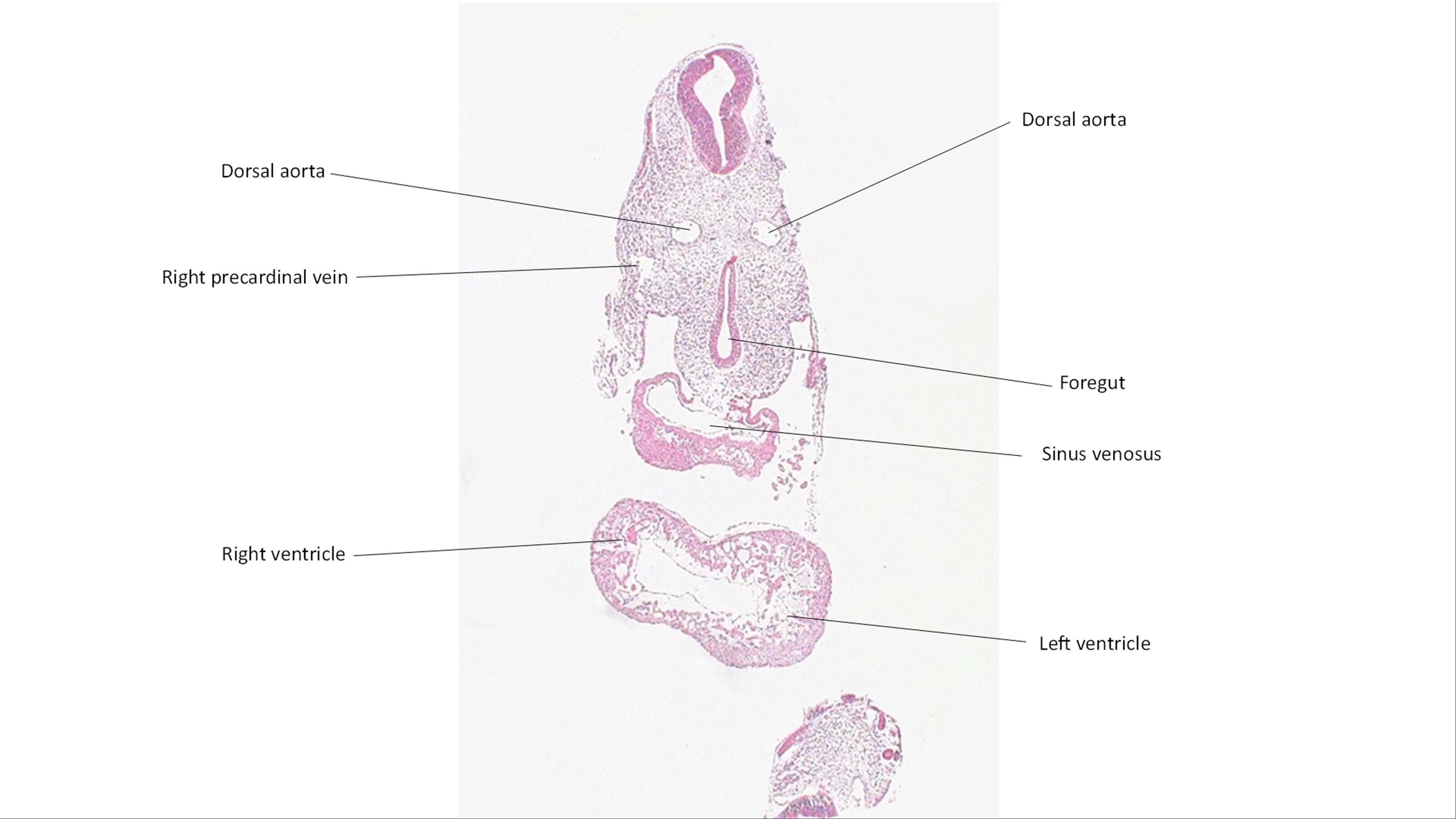 A histology section of a human embryo