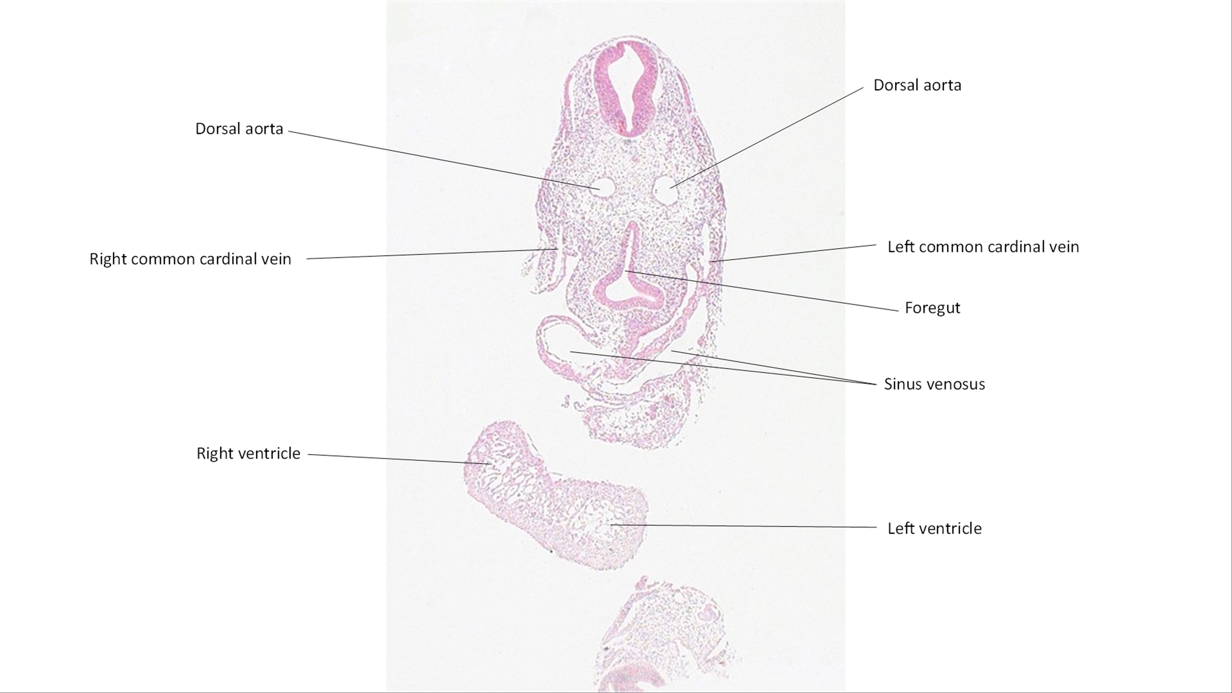 A histology section of a human embryo
