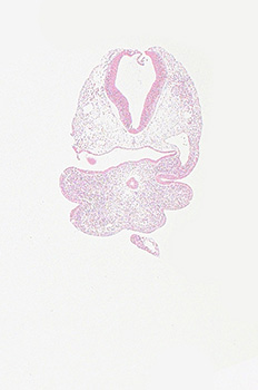 A histology section of a human embryo