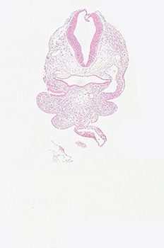 A histology section of a human embryo