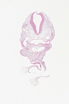 A histology section of a human embryo