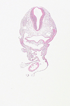 A histology section of a human embryo