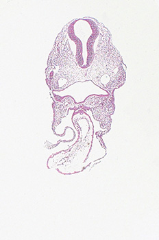 A histology section of a human embryo