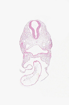A histology section of a human embryo