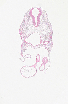 A histology section of a human embryo