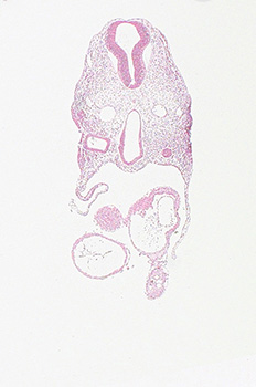 A histology section of a human embryo