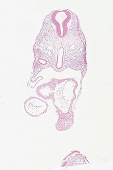 A histology section of a human embryo