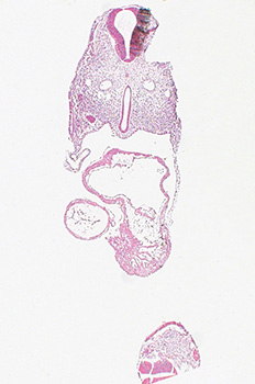 A histology section of a human embryo