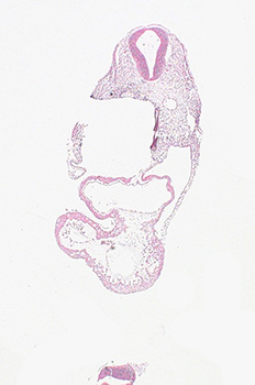 A histology section of a human embryo