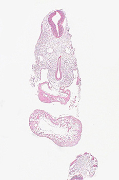 A histology section of a human embryo