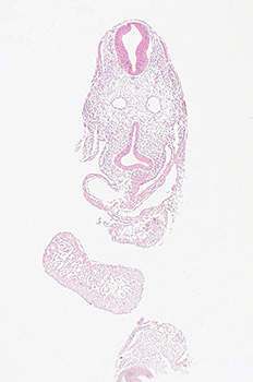 A histology section of a human embryo