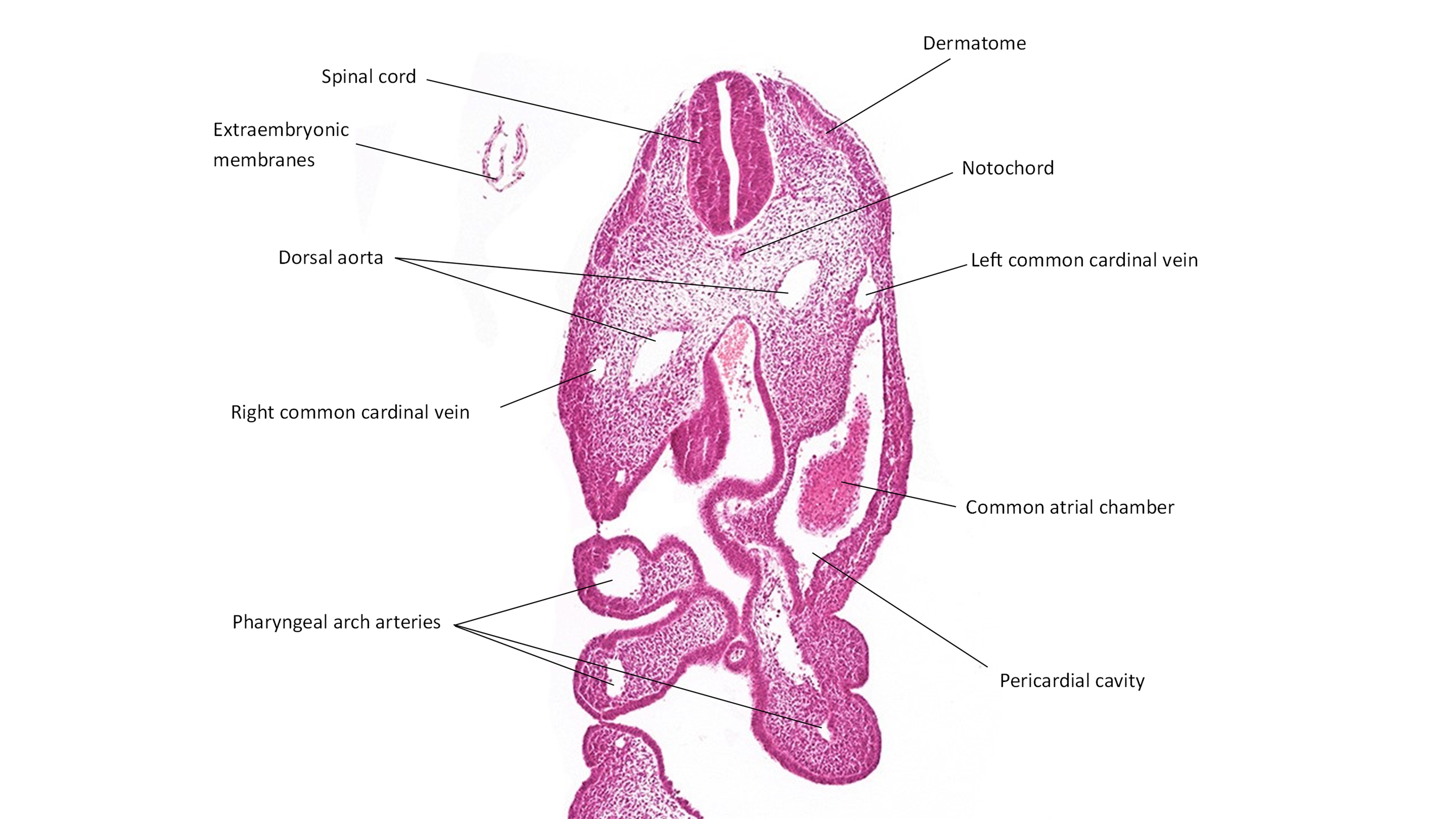 A histology section of a human embryo