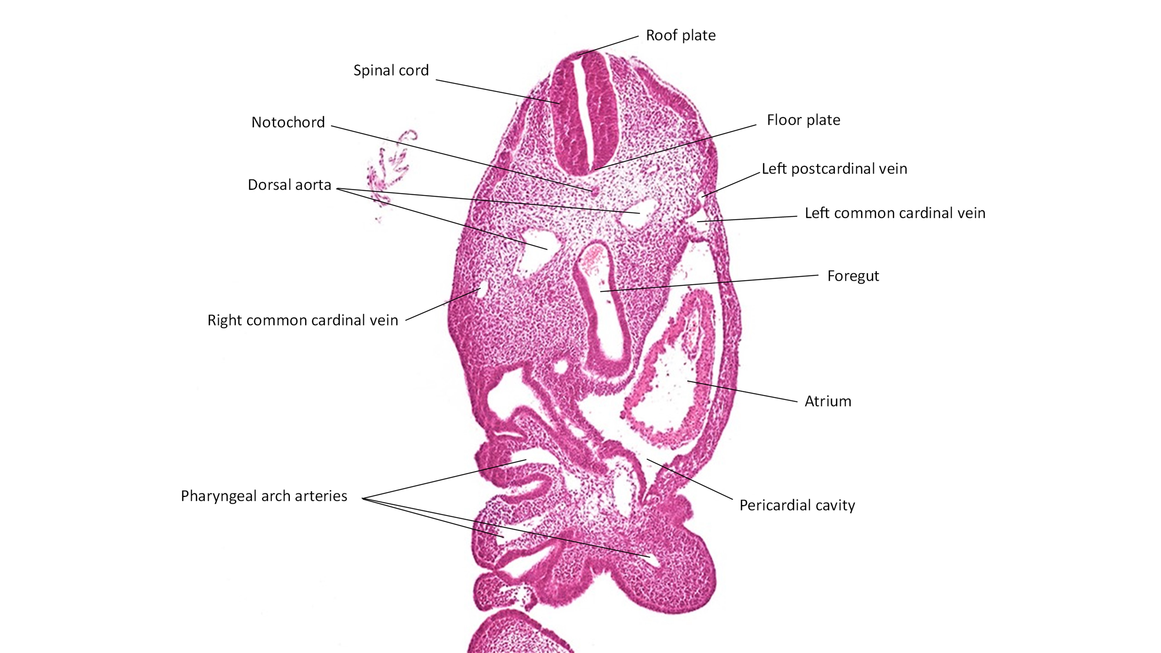 A histology section of a human embryo