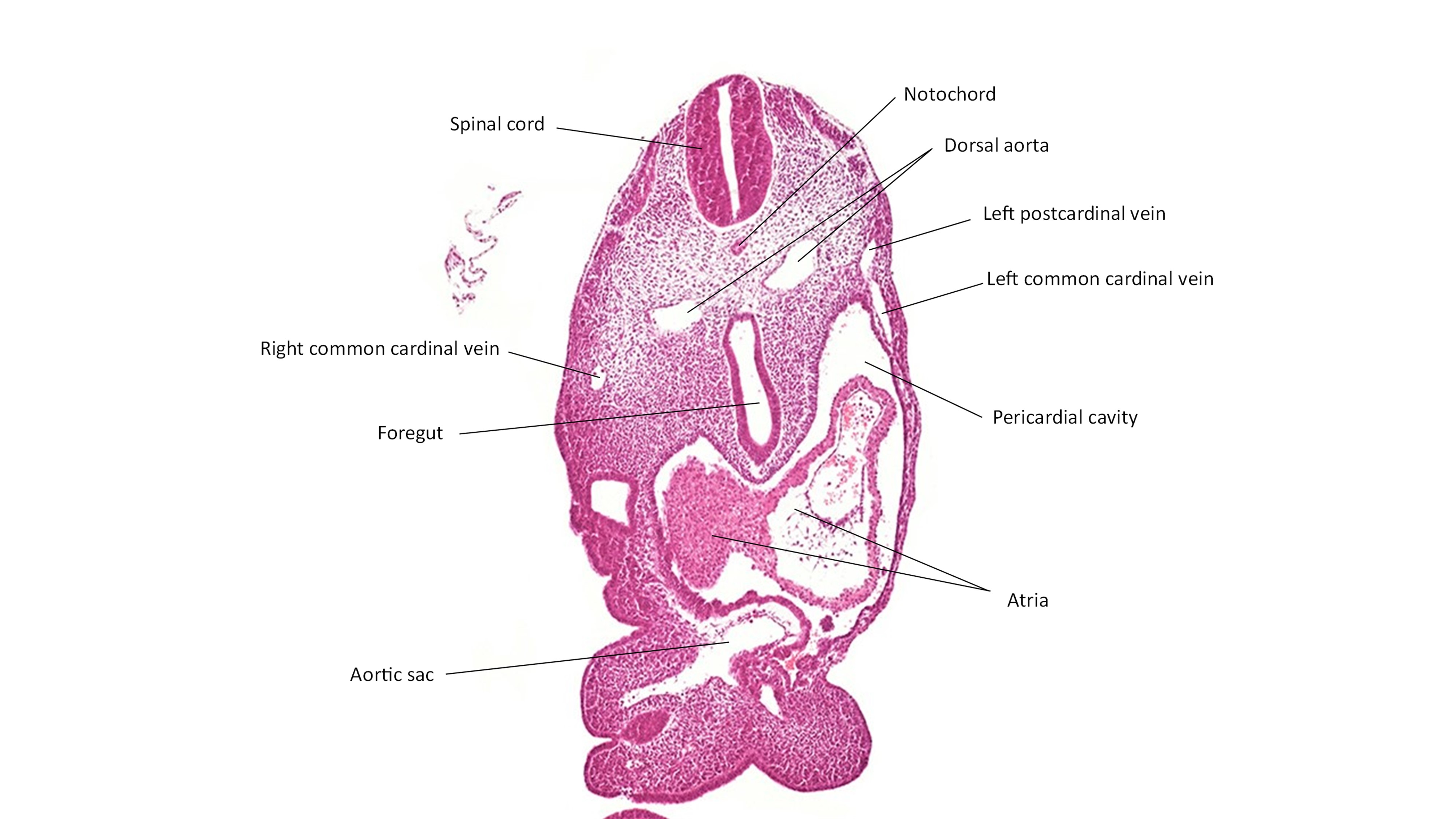 A histology section of a human embryo
