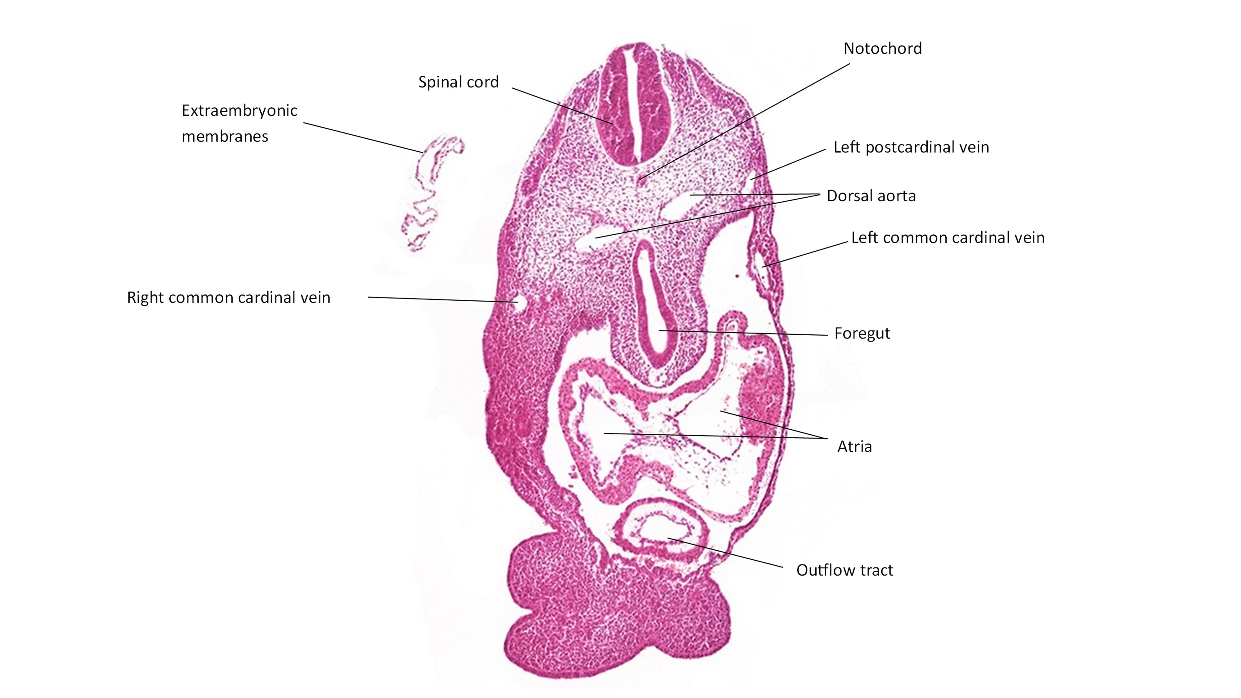 A histology section of a human embryo