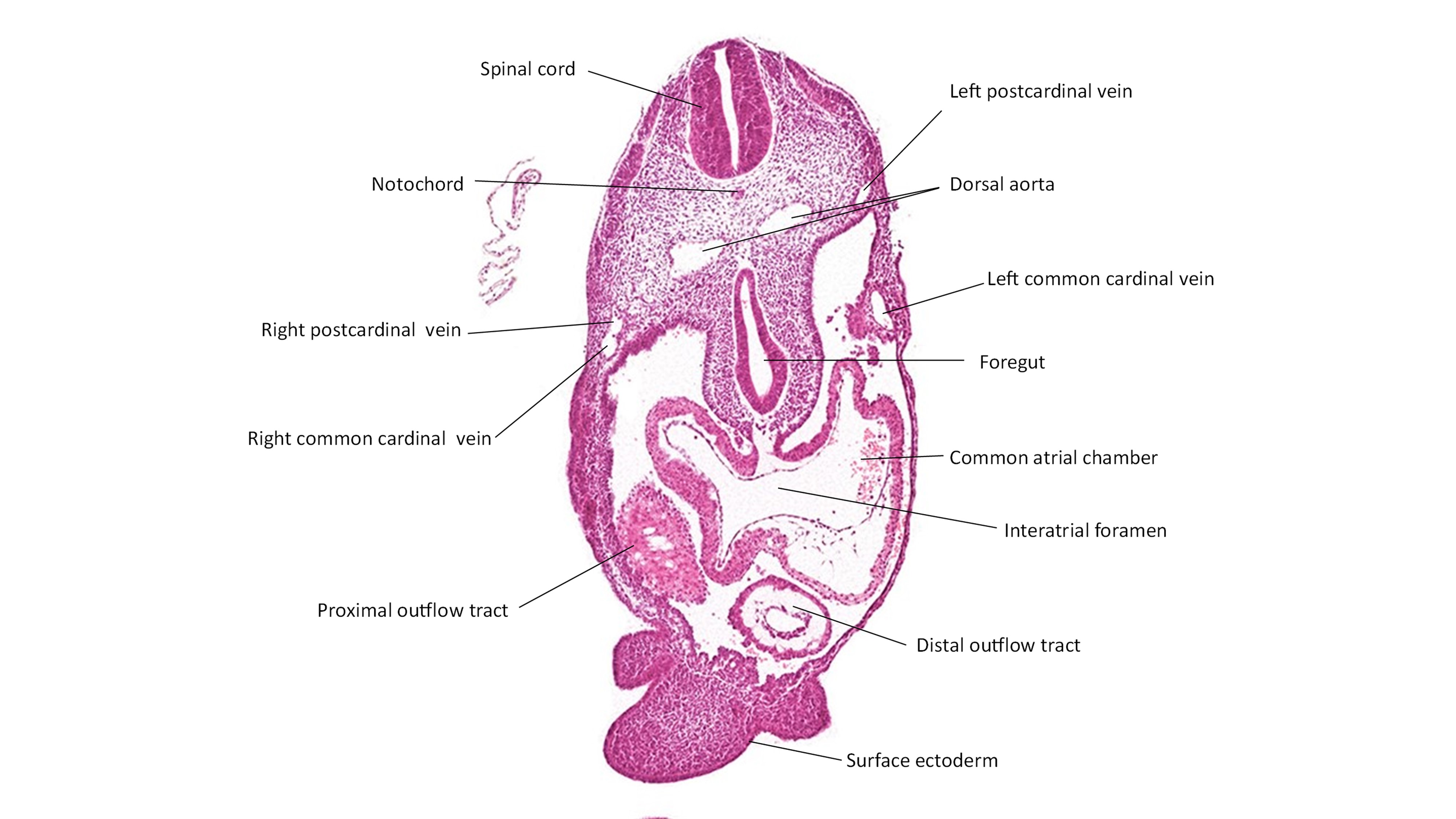 A histology section of a human embryo