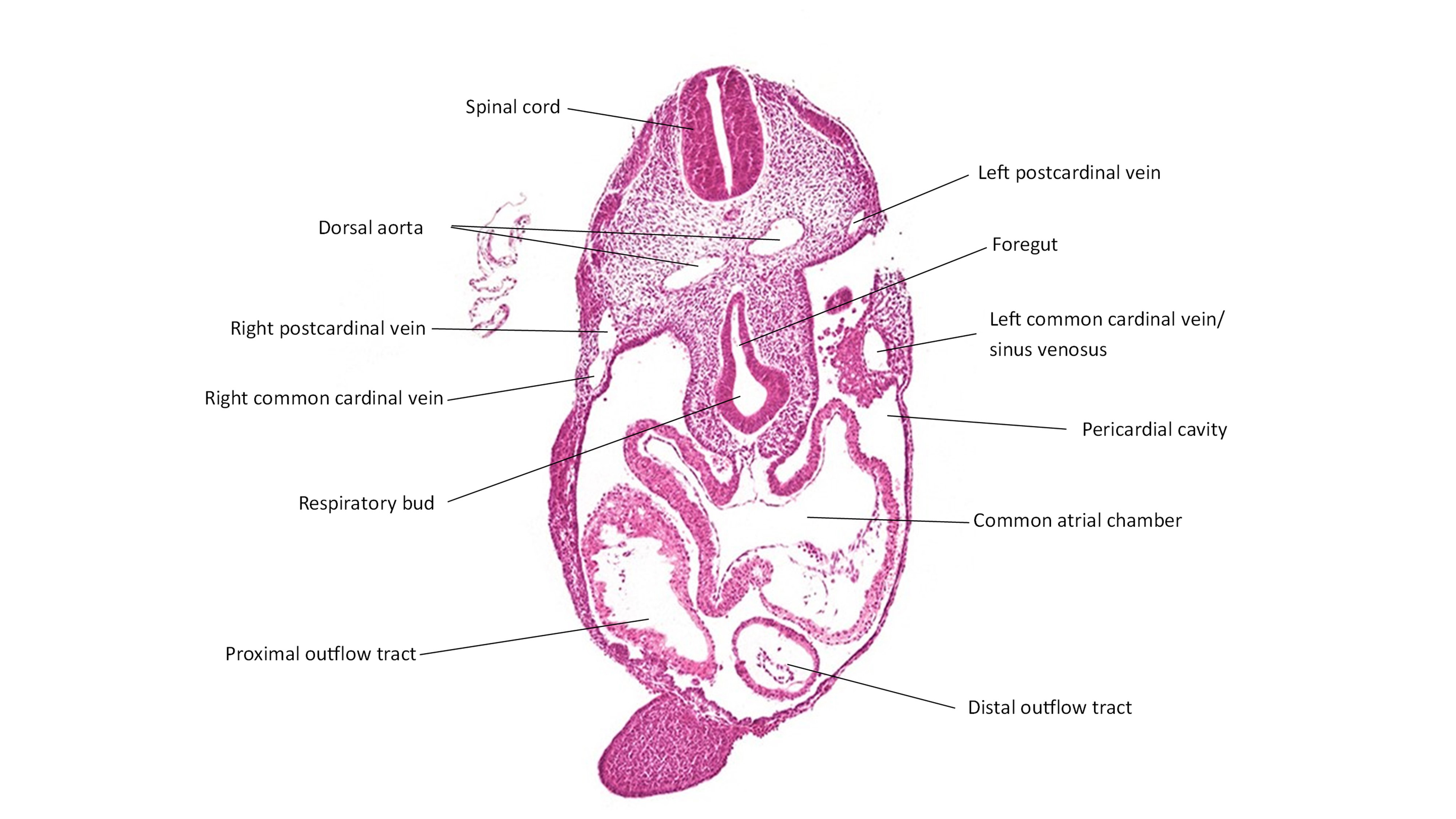 A histology section of a human embryo