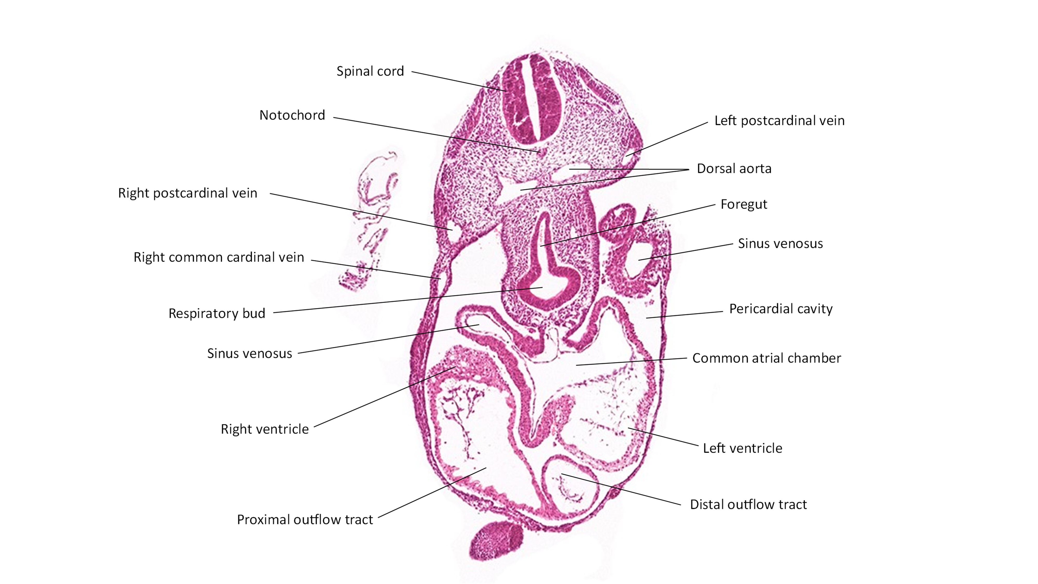 A histology section of a human embryo