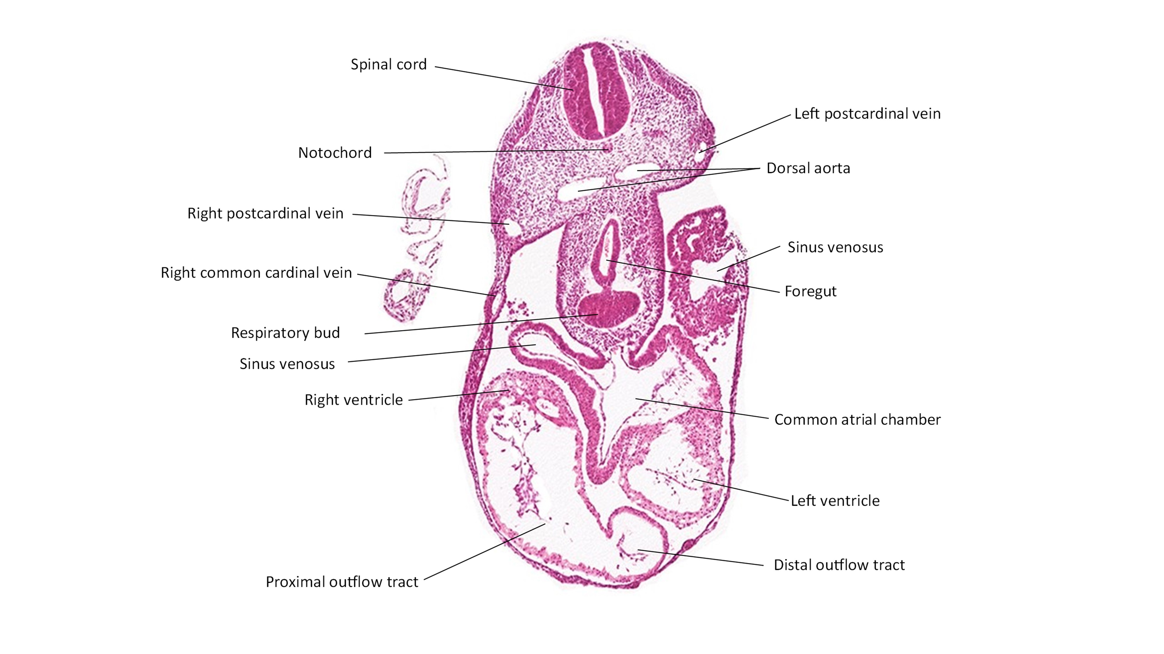 A histology section of a human embryo