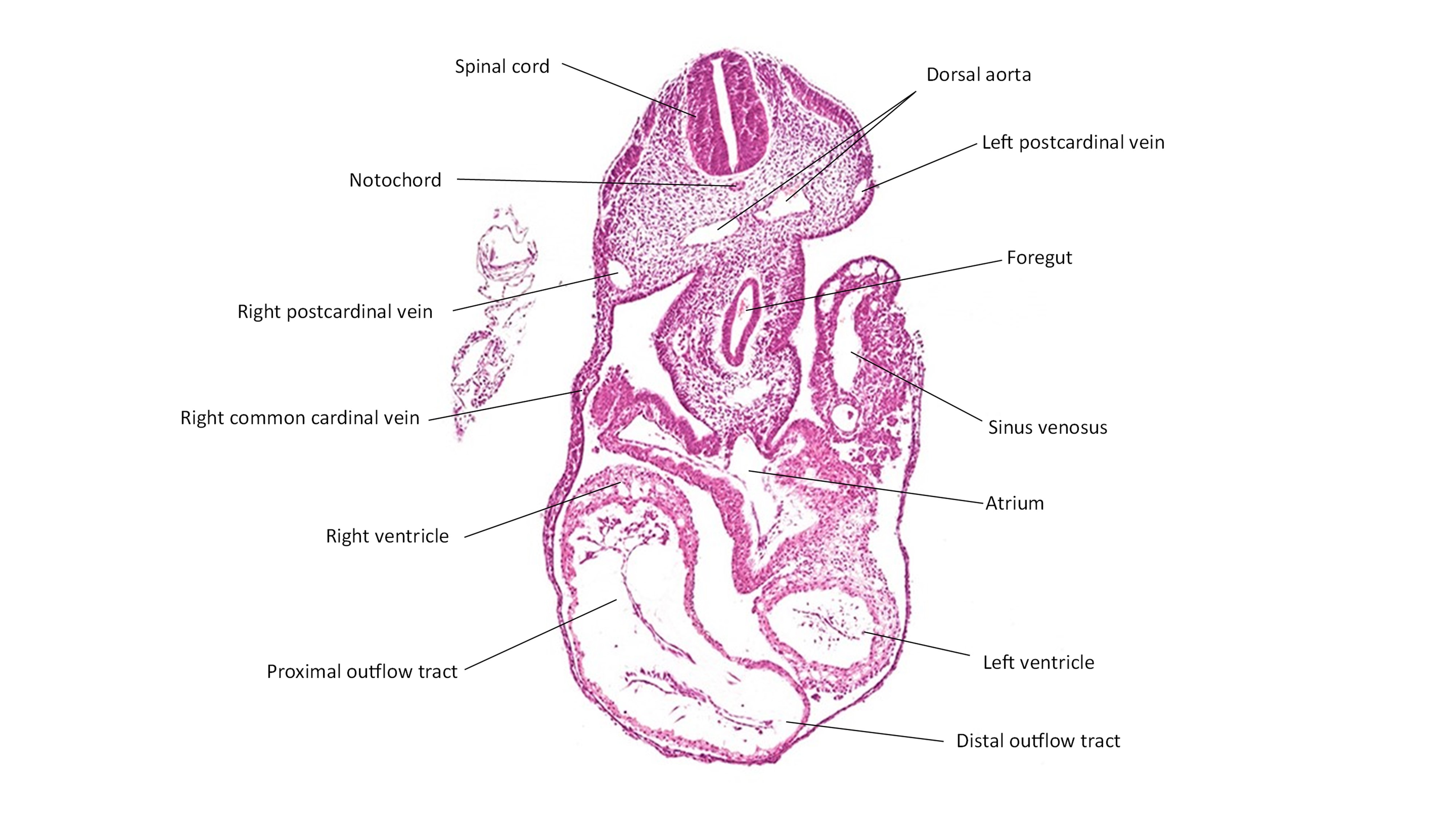 A histology section of a human embryo