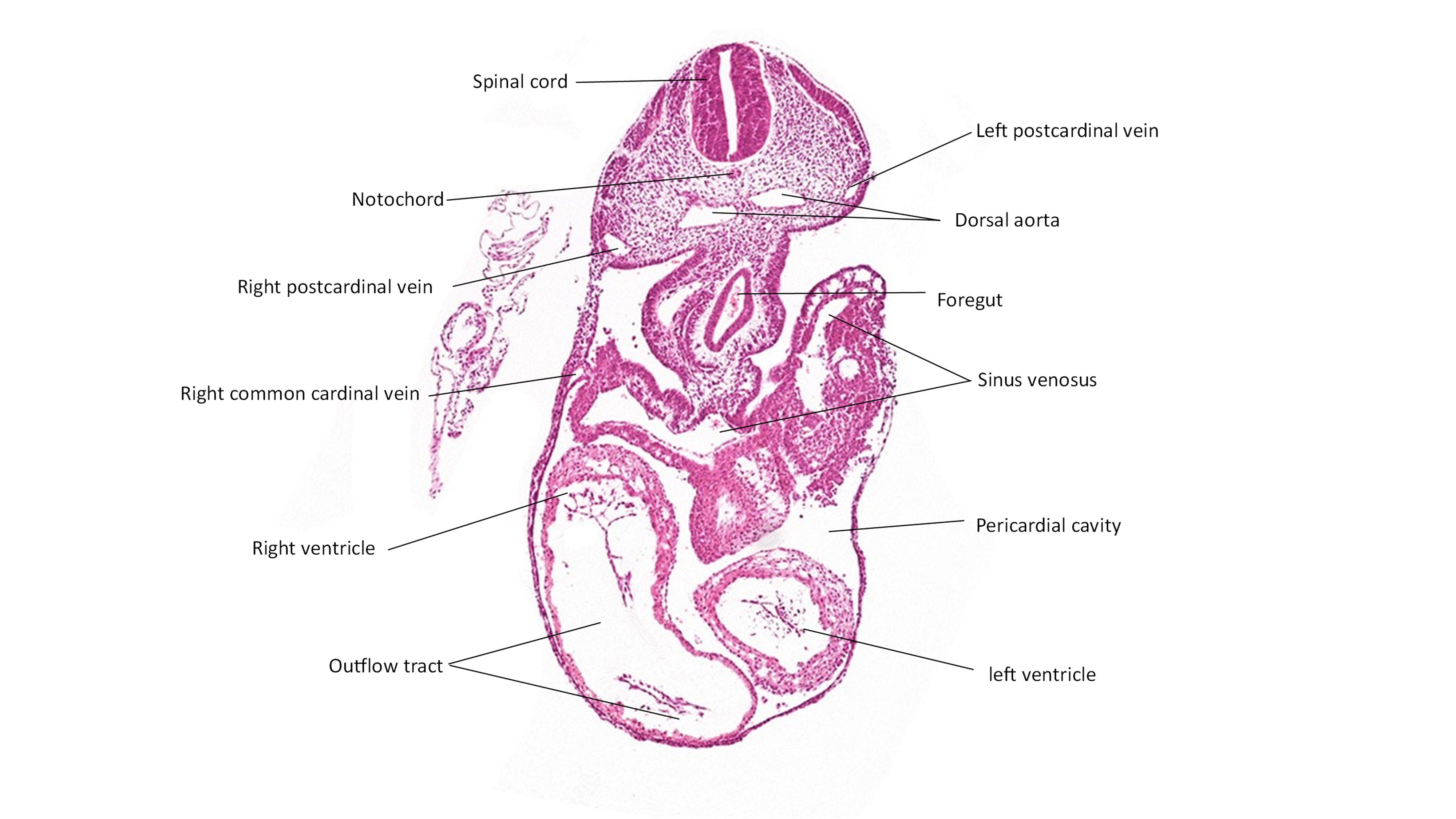 A histology section of a human embryo