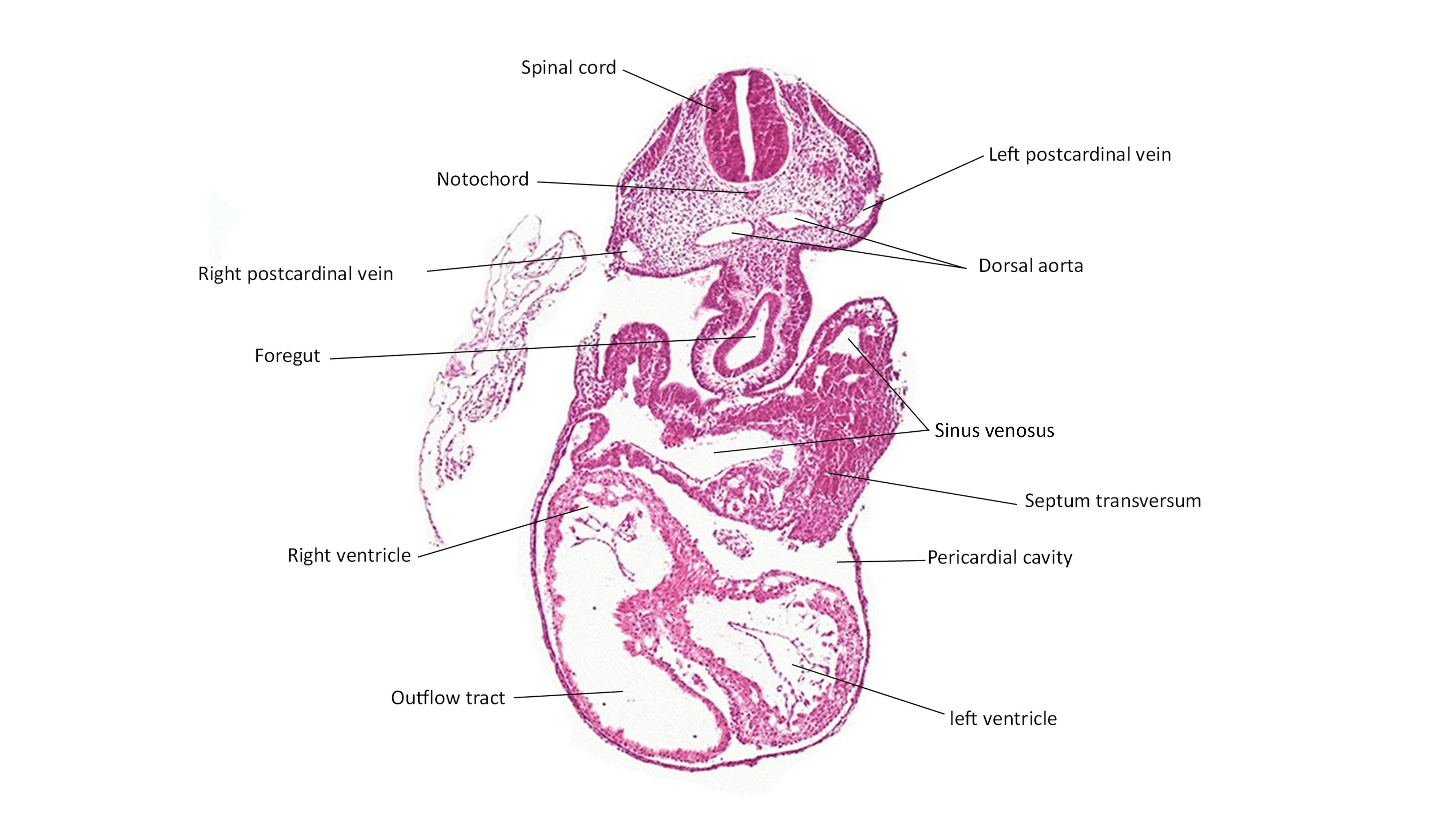 A histology section of a human embryo