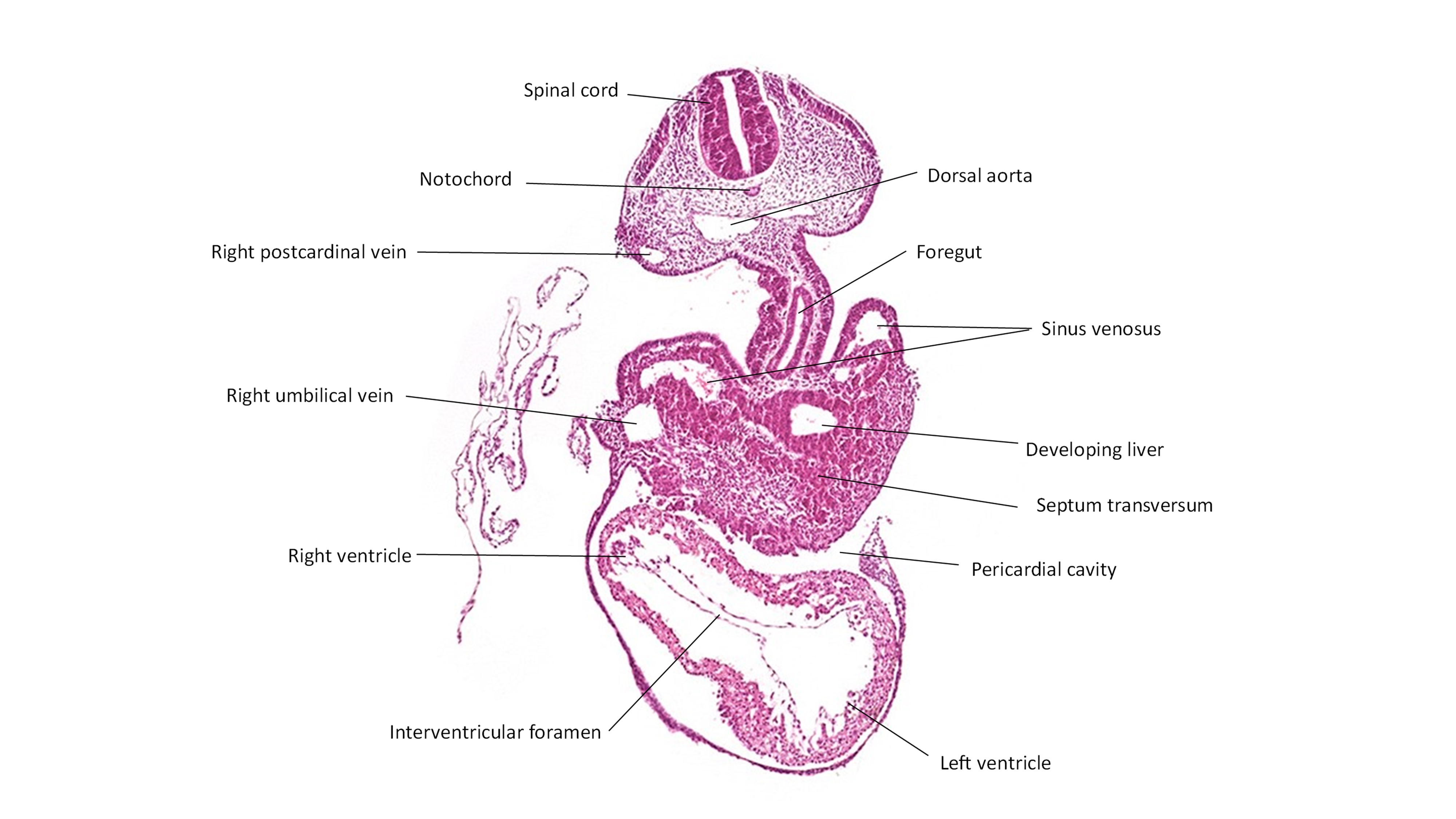 A histology section of a human embryo
