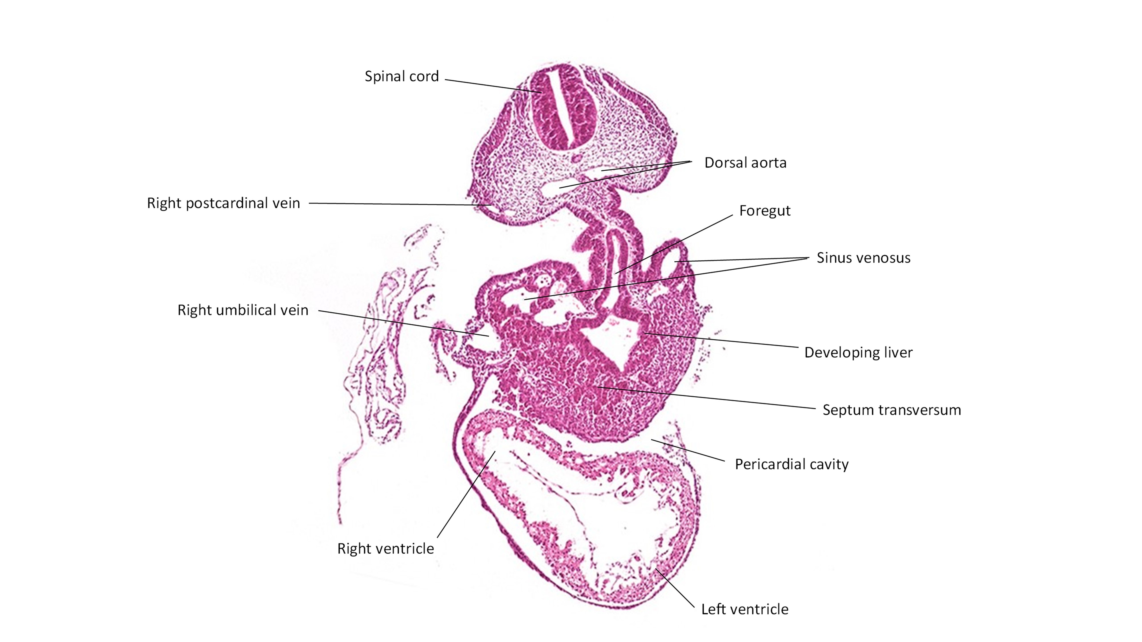 A histology section of a human embryo