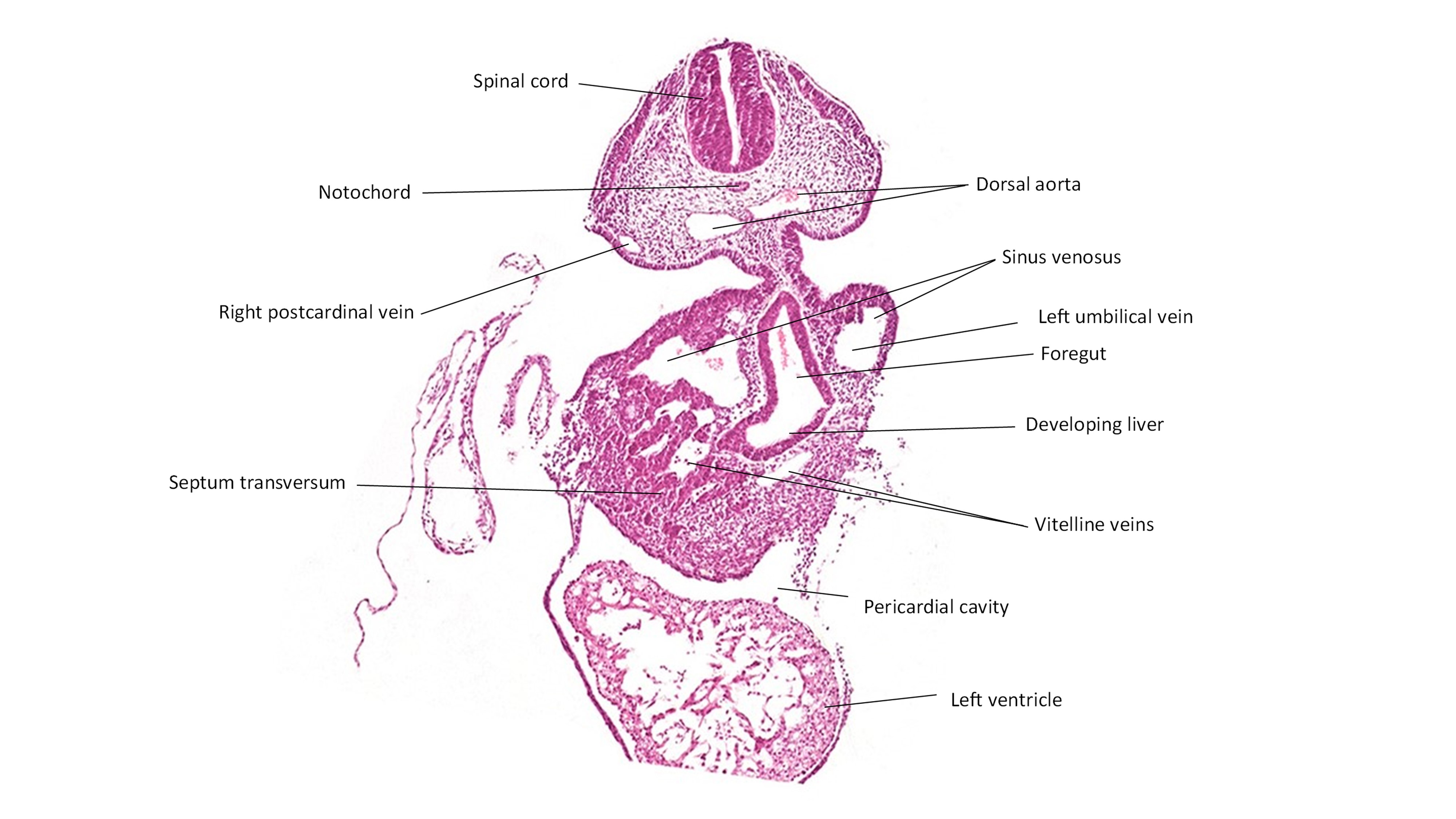 A histology section of a human embryo