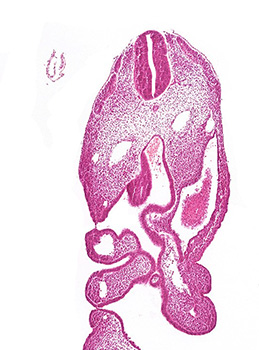 A histology section of a human embryo