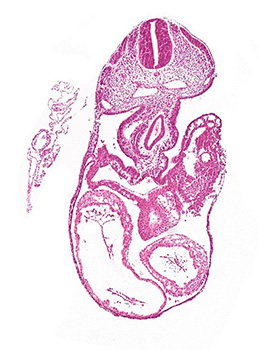 A histology section of a human embryo