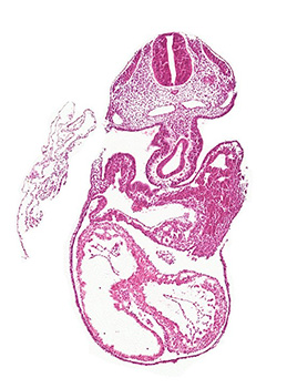 A histology section of a human embryo