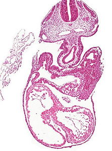 A histology section of a human embryo