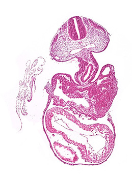 A histology section of a human embryo