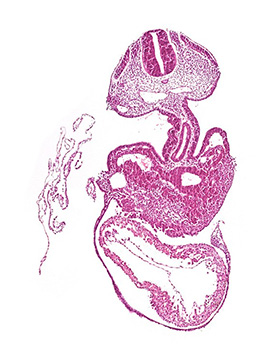 A histology section of a human embryo