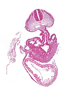 A histology section of a human embryo