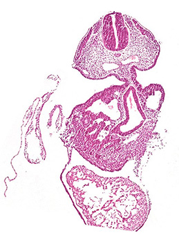 A histology section of a human embryo